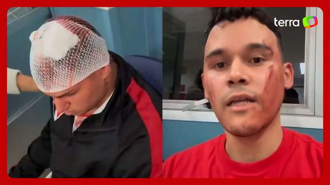 Torcedor do São Paulo atingido por placa no Morumbis relata situação: ‘Precisei invadir o campo’