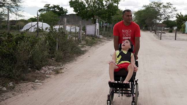 Como estão crianças com microcefalia uma década após a epidemia de Zika